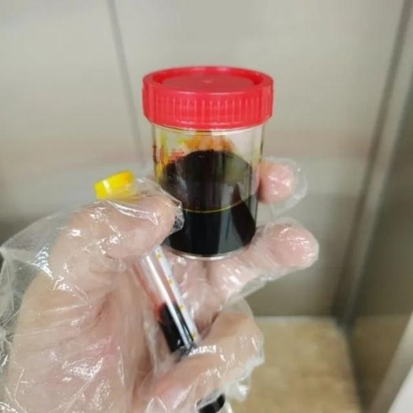 急性肝衰竭！兩兄弟誤吃這種菌 專家提醒